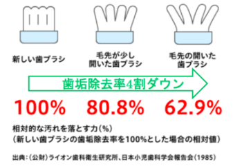 歯ブラシ　寿命　杉田デンタルクリニック.png